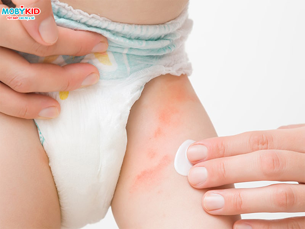 Hướng dẫn cách phân biệt bỉm Huggies thật và giả siêu dễ dàng