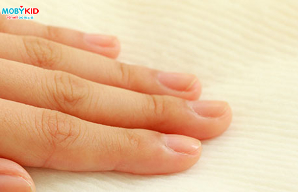 Bí kíp chọn bỉm tốt cho trẻ sơ sinh mùa hè không lo bé bị hăm tã 