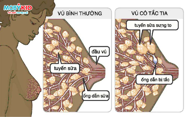 me-tac-sua-nen-chon-may-hut-sua-nao-2